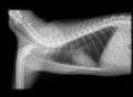 Tipos de radiologías. Las radiografías de contraste