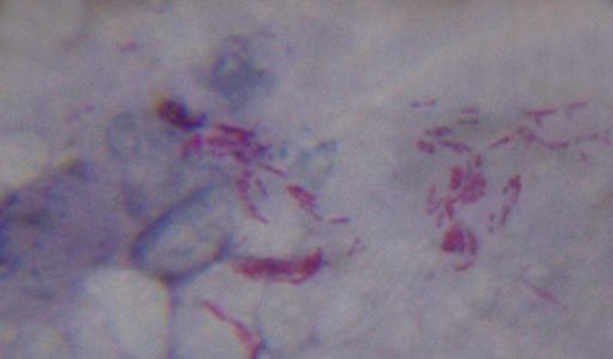 antropozoonosis