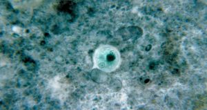 Parásitos intestinales en humanos (protozoos, nematodos y cestodos)