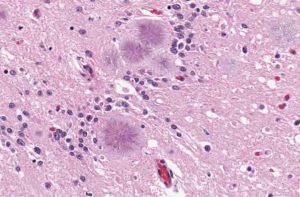 Priones, qué son, estructura y tipos. Proteína priónica normal y anómalas