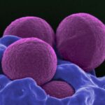 staphylococcus-aureus