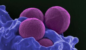 Staphylococcus aureus